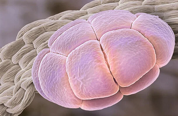 Bu polenler ipek ağacına ait.