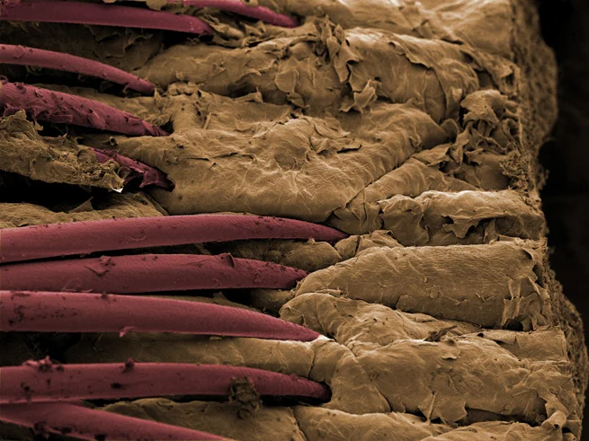 Deriden çıkan kıllar..