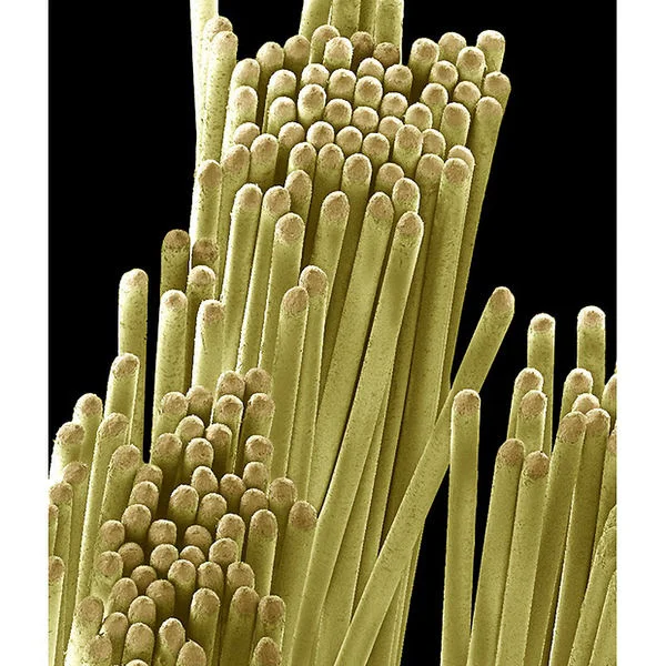 diş fırçası kılı